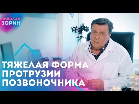 Тяжелая форма протрузия межпозвонковых дисков. Нейрохируг Зорин Николай Александрович