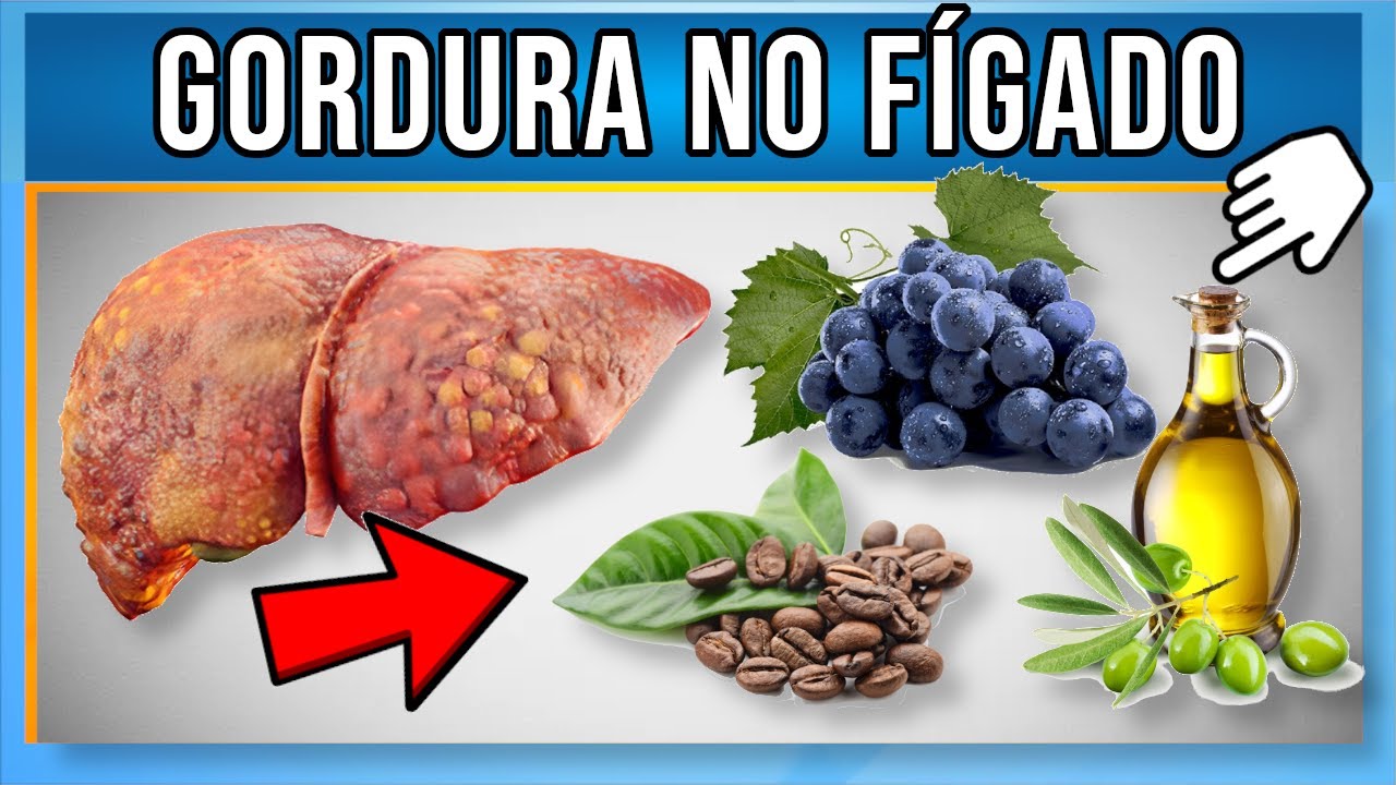 Os 5 Melhores Alimentos para GORDURA NO FÍGADO - YouTube
