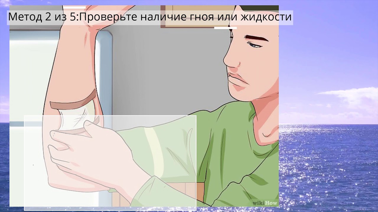 Как проверить, не воспалилась ли рана