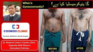 What is Gynaecomastia /  گا ینیکومیسٹیا کیا ہے؟