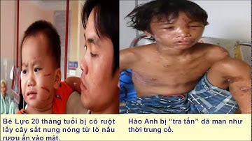 GDCD 6:  Các quyền cơ bản của công dân (t1)