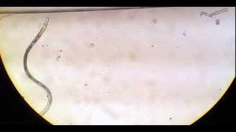 Nematode worms seen under light microscope