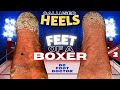 Feet of a Boxer: Knocking Out Painful Calluses, Round 2: The Heels