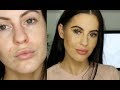 How To Cover Pimples and Dull Skin | Natural Makeup Tutorial