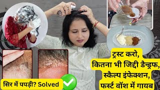 Goodbye Dandruff - इन स्ट्रॉन्ग चीजों से मिटाए Dandruff, Hairfall