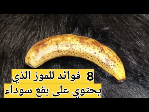تعرفي معي على فوائد الموز الذي يحتوي على بقع سوداء     