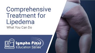 Comprehensive Treatment for Lipedema: What You Can Do