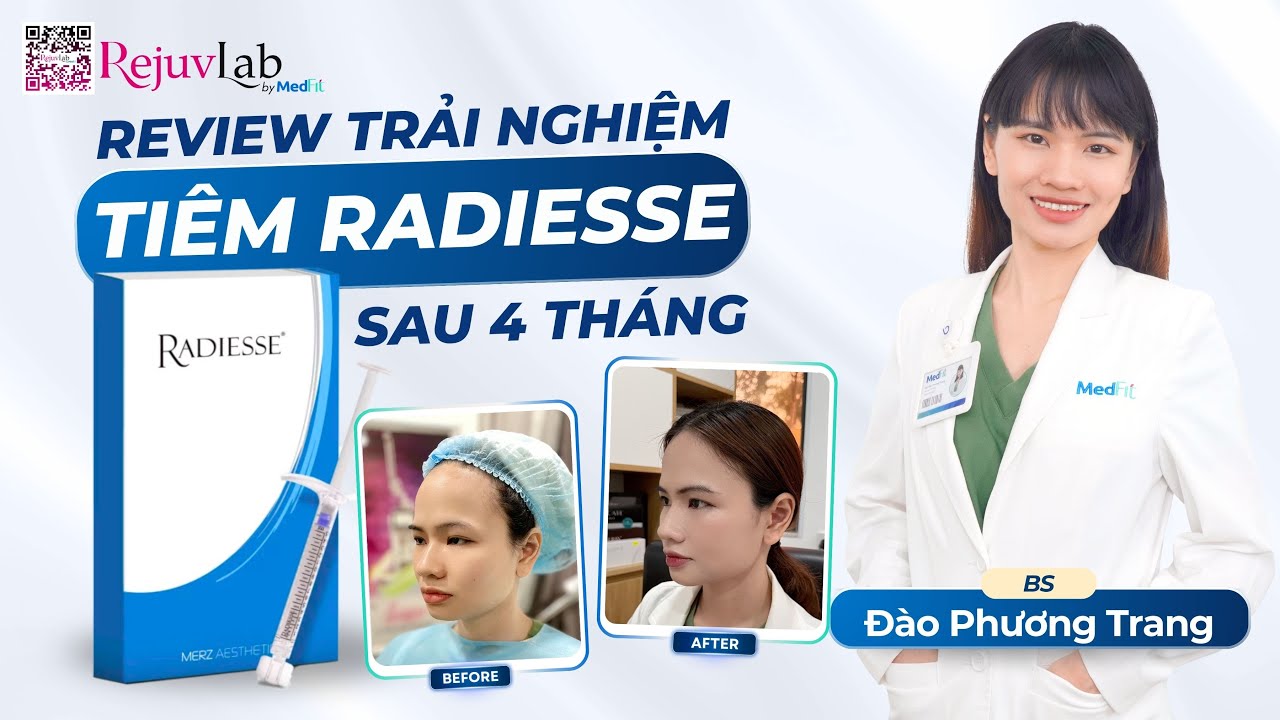 youtube-video-thumbnail