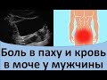 Боль в паху и кровь в моче у мужчины