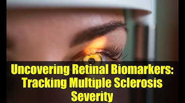 Uncovering Retinal Biomarkers: Tracking Multiple Sclerosis Severity