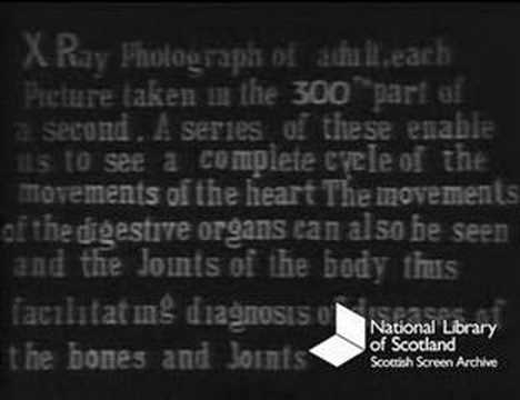 Dr. MacIntyre's X-Ray Film (Silent, 1896 and 1909)