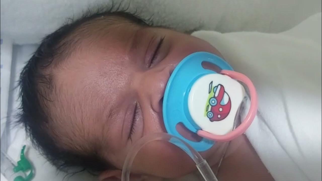 Are pacifier good or bad? benefit ( SIDS, pain distraction) risk ( ear