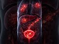 Stage 4 Bladder Cancer Treatment in Germany |  Immunotherapy Dendritic Cell Therapy in Germany