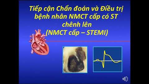 Nhồi máu cơ tim cấp ST chênh lên STEMI   Hội chứng vành cấp