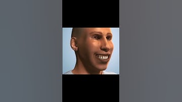 Sinus Lift And Bone Graft Dental Surgery #shorts