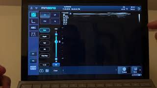 MiniSono - transfer study to a USB memory