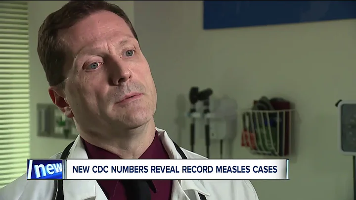 Measles outbreak is largest in US in 25 years, CDC says