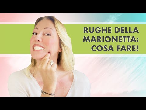 Rughe della marionetta: tutto quello che devi sapere