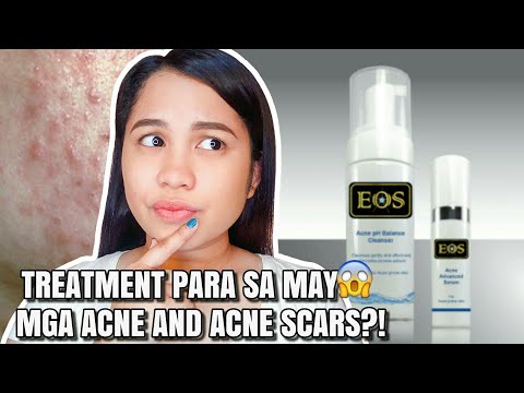ANG SOLUSYON SA MGA ACNE AND ACNE SCARS | EOS ACNE CLEANSER & SERUM + GIVEAWAY!!! ( CLOSED)
