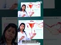 #endometrium | Endometrium உள்ளவர்களுக்கு ஏற்படும் பாதிப்புகள் என்ன ? | Dr. B.Yoga Vidhya
