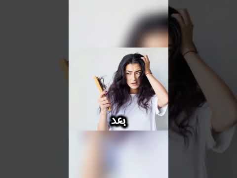 هاذه الفتاة البالغة من العمر14 عاما لديها حشرات على شعرها وما اكتشفه الاطباء داخل رأسها صدم العالم