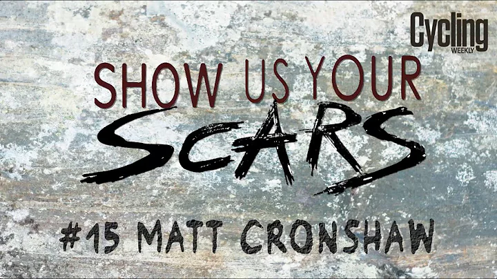 Show us your Scars: Matt Cronshaw | Cycling Weekly