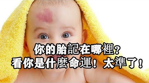 你的胎记在哪里？看你是什么命运！太准了！ - 天天要闻