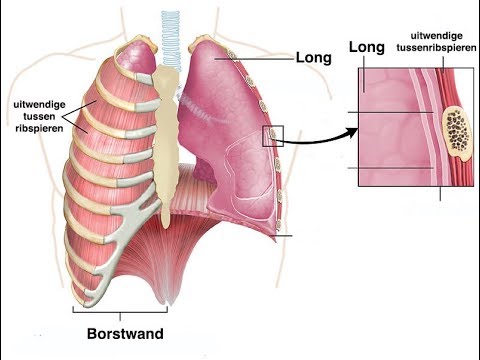 Video: Longconsolidatie: Behandeling, Versus Pleurale Effusie En Meer