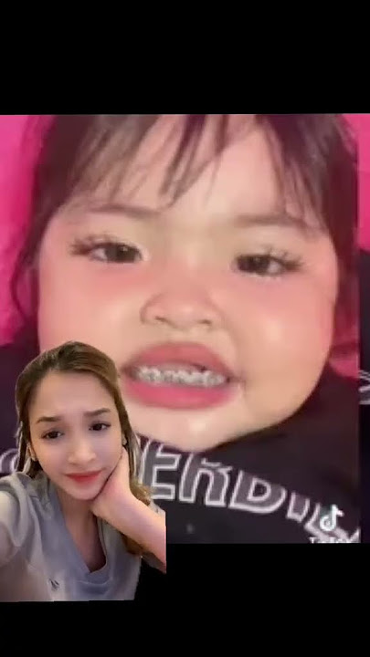 Anak Kecil pake behel😱