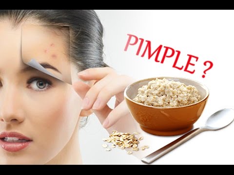 Treatment of Acne Scars with Oat Meal