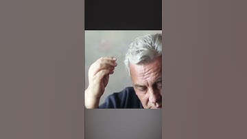 3 nguyên nhân hàng đầu gây rụng tóc #suckhoe #shorts #fyp #xuhuong #vitamin #drvitamin