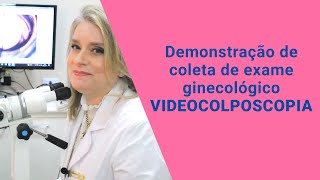 Demonstração De Coleta De Exame Ginecológico - Videocolposcopia Dra. Christiane Curci Régis