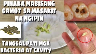 MABISANG GAMOT SA SAKIT NG NGIPIN | SUPER EFFECTIVE AND SAFE - Jery Napare