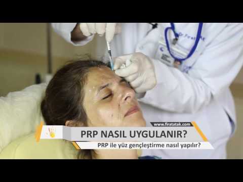 Video: PRPP endirimi nədir?