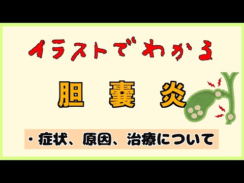 【５分で解説】胆石と胆嚢炎の関係性と症状