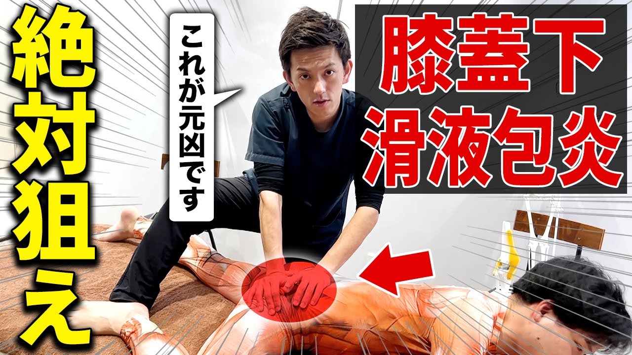 【全治療家必見】膝の痛みの原因はほぼ『膝蓋下滑液包炎』！?これだけ見れば治療をマスターできます！