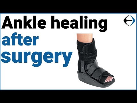 Ankle Surgery: How long does it take for your ankle to heal after surgery?