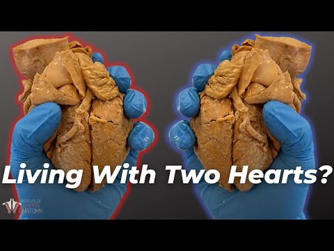 Video: Što opskrbljuje peronealna arterija?
