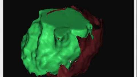 thera-acquisition.mp4