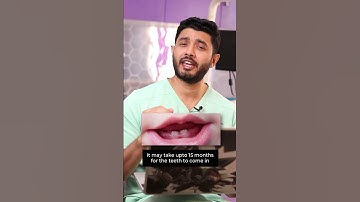 My One-Year Old Baby Has No Teeth. Should I Be Worried? | Dr. Jibran