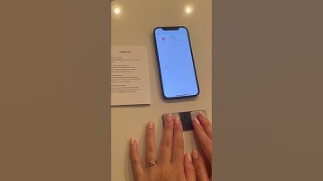 Kardia mobile device #ekg #cardiac