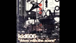 Kid606 - It&#39;ll Take Millions In Plastic Surgery To Make Me Black