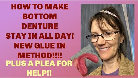 Bottom denture stays in all day. Life with Dentures