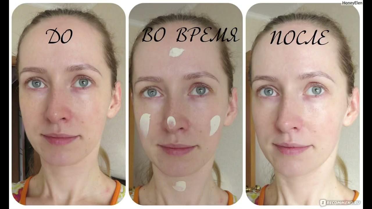 До и после отбеливающий для лица Отбеливающий крем для лица Faberlic Expert SPF 15. Для заказа пишите в WhotsApp 