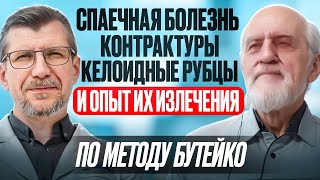 видео: Интервью с прямым учеником Бутейко: Доктором Сергеем Сулягиным. Излечение спаек, рубцов, контрактур. картинка: Интервью с прямым учеником Бутейко: Доктором Сергеем Сулягиным. Излечение спаек, рубцов, контрактур.