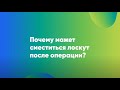 🔷 Может ли сместиться лоскут после операции (лазерной коррекции зрения)? 🔷