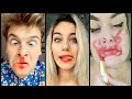 #tiktok #tiktokcompilation #LipChallenge TIK TOK LIP CHALLENGE COMPILATION TOP 5