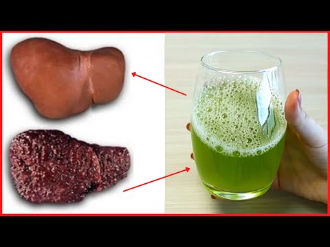 Home Remedy for Fatty Liver or Fatty Liver Disease