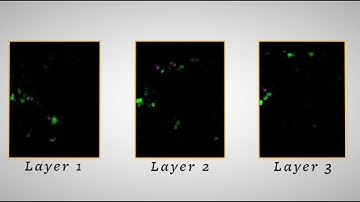 Activating brain cells with holography