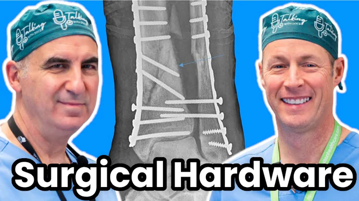 Should I Have My Plate And Screws Removed?  Hardware Removal Surgery